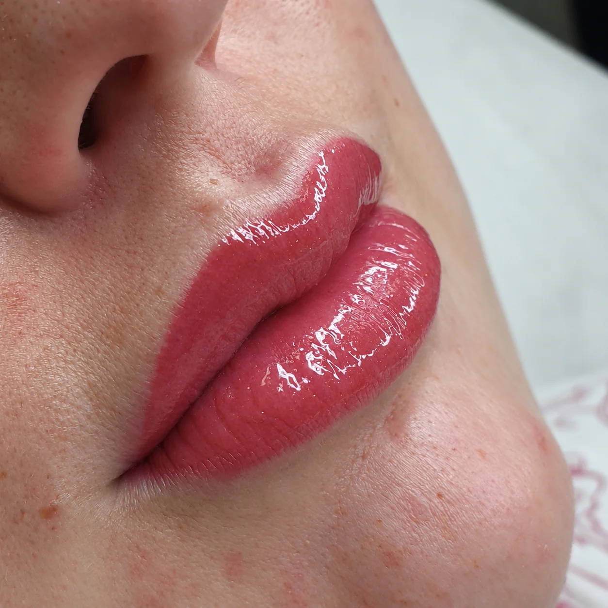 Lip blush treatment showing restored colour along the lip border